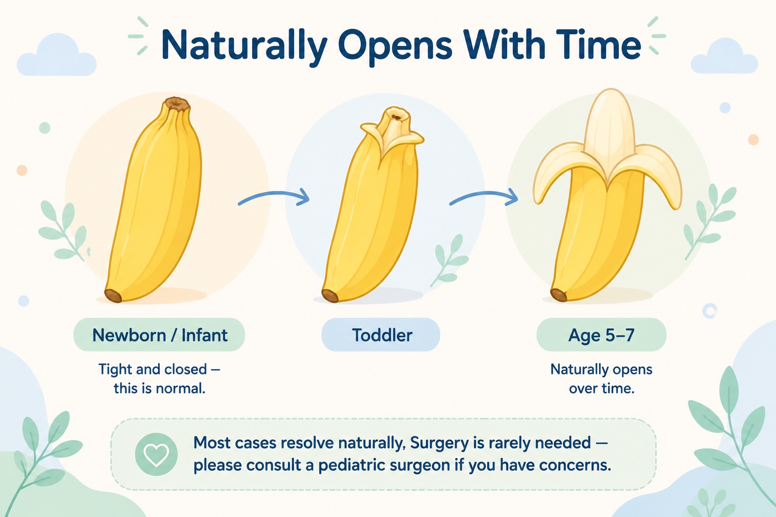 Phimosis in boys: banana metaphor showing foreskin naturally opens with age