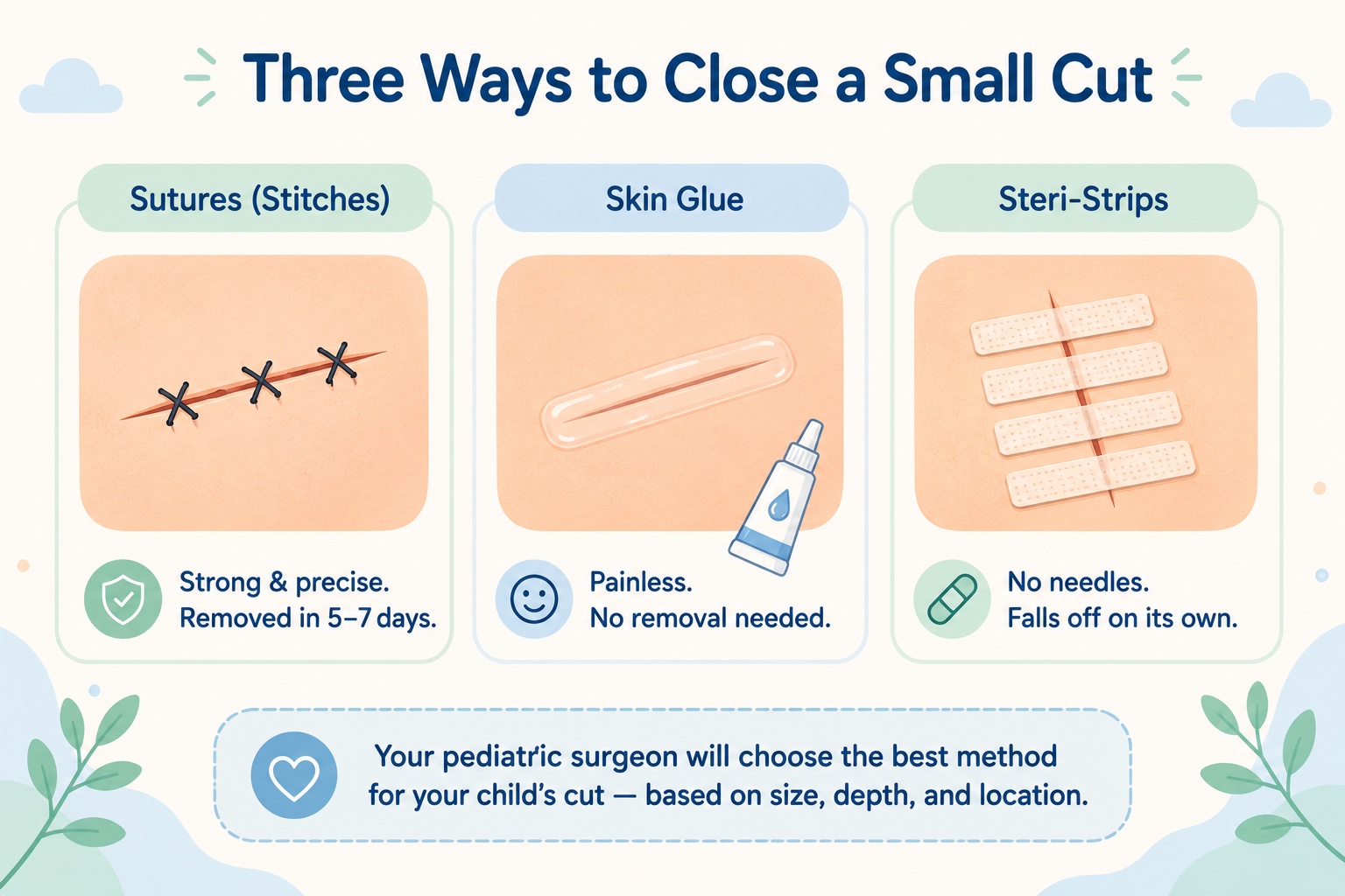 Sutures, skin glue, and steri-strips: three ways to close a small cut in children