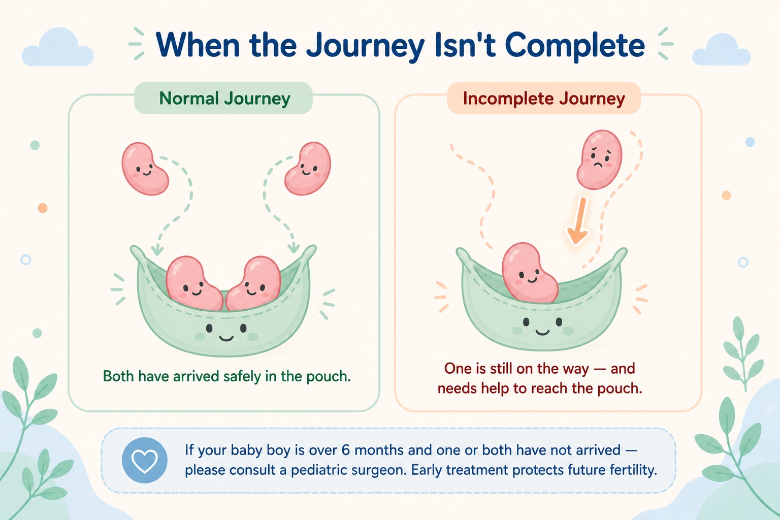 Undescended testis in baby boys: friendly pouch metaphor showing normal vs incomplete journey