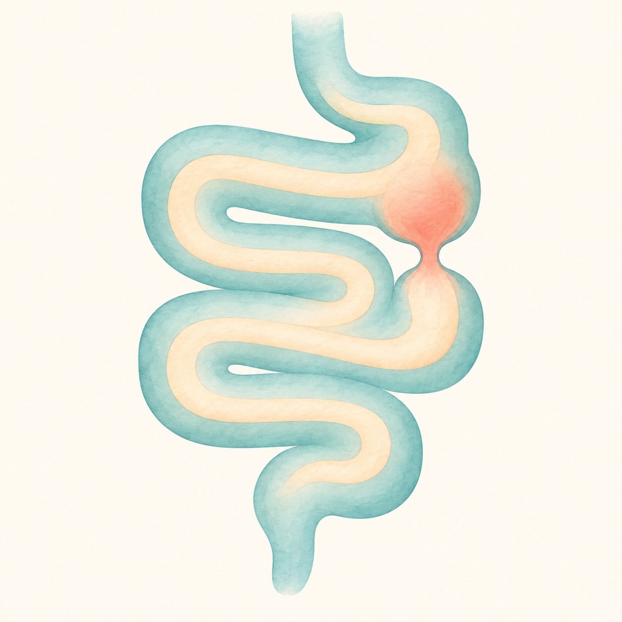 Illustration of a child bowel with a blocked, narrowed section