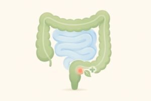 Illustration of a child's lower bowel showing the site of a perianal abscess